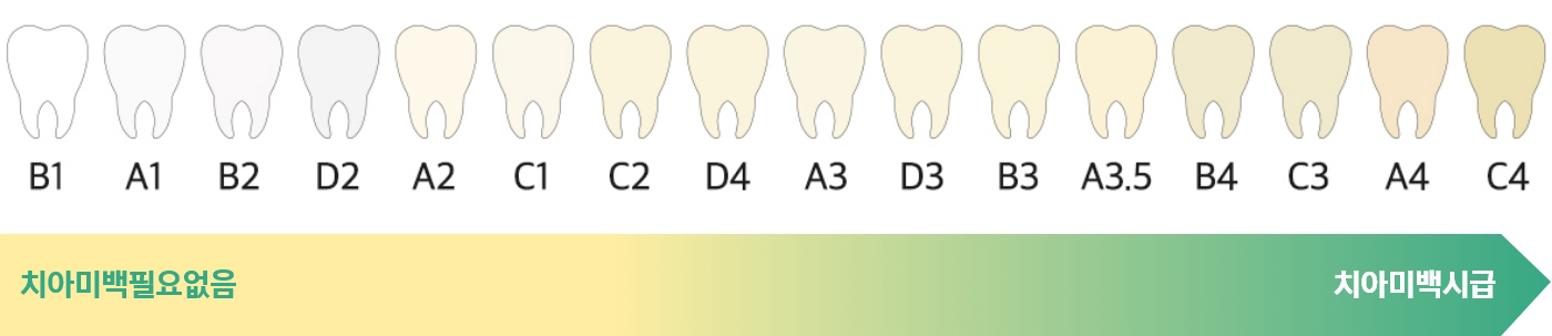 치아미백자가진단